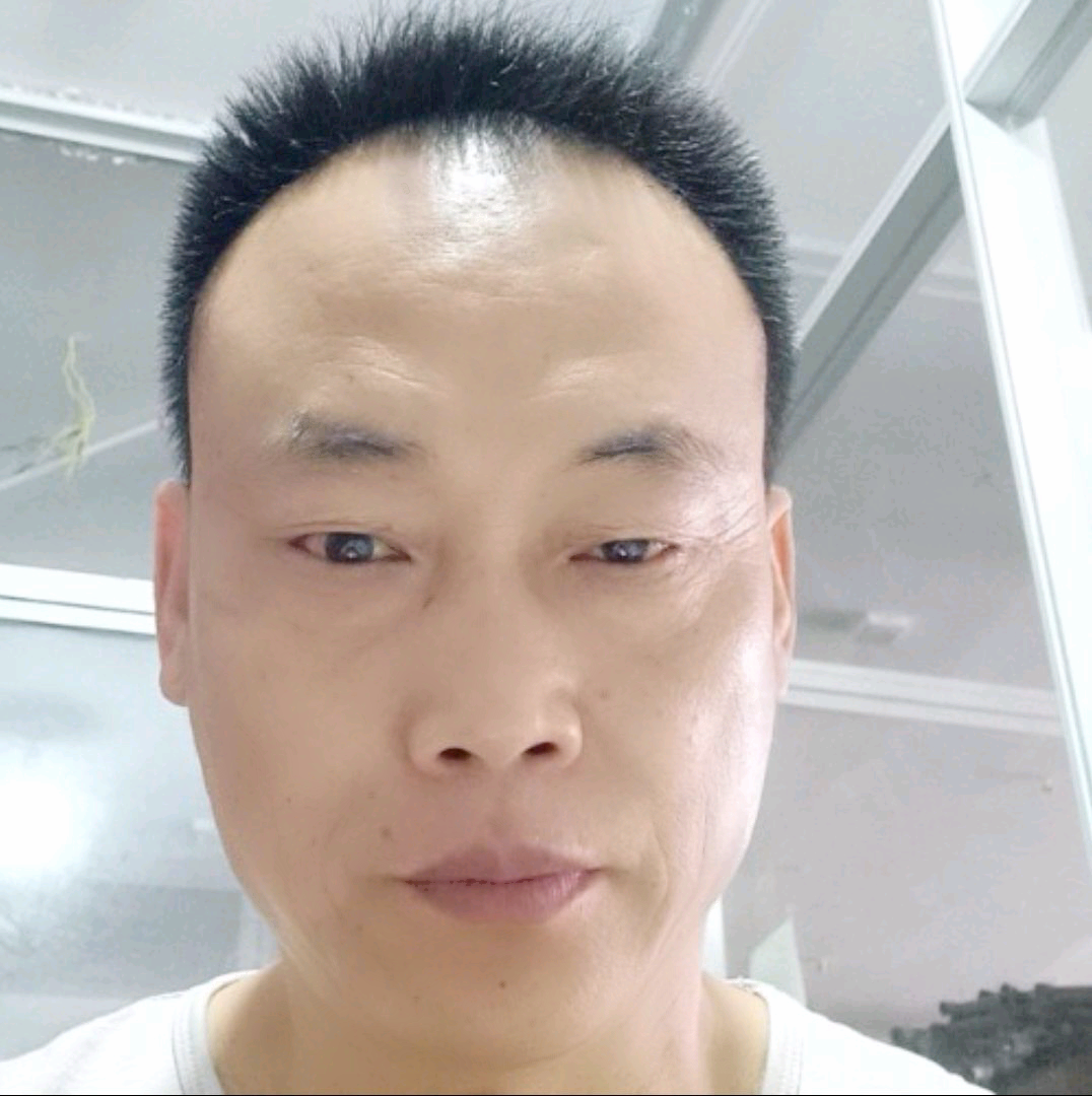 笑靥那忧郁的照片