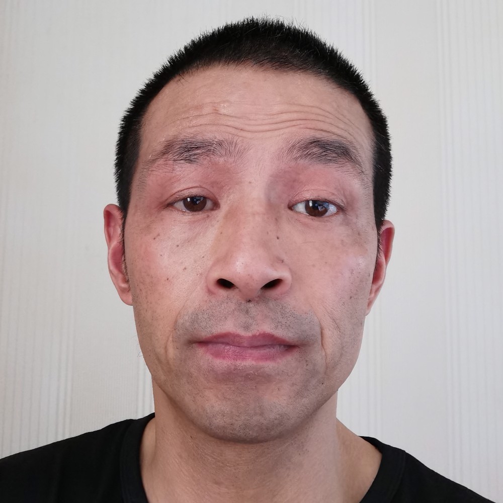 X  L的照片