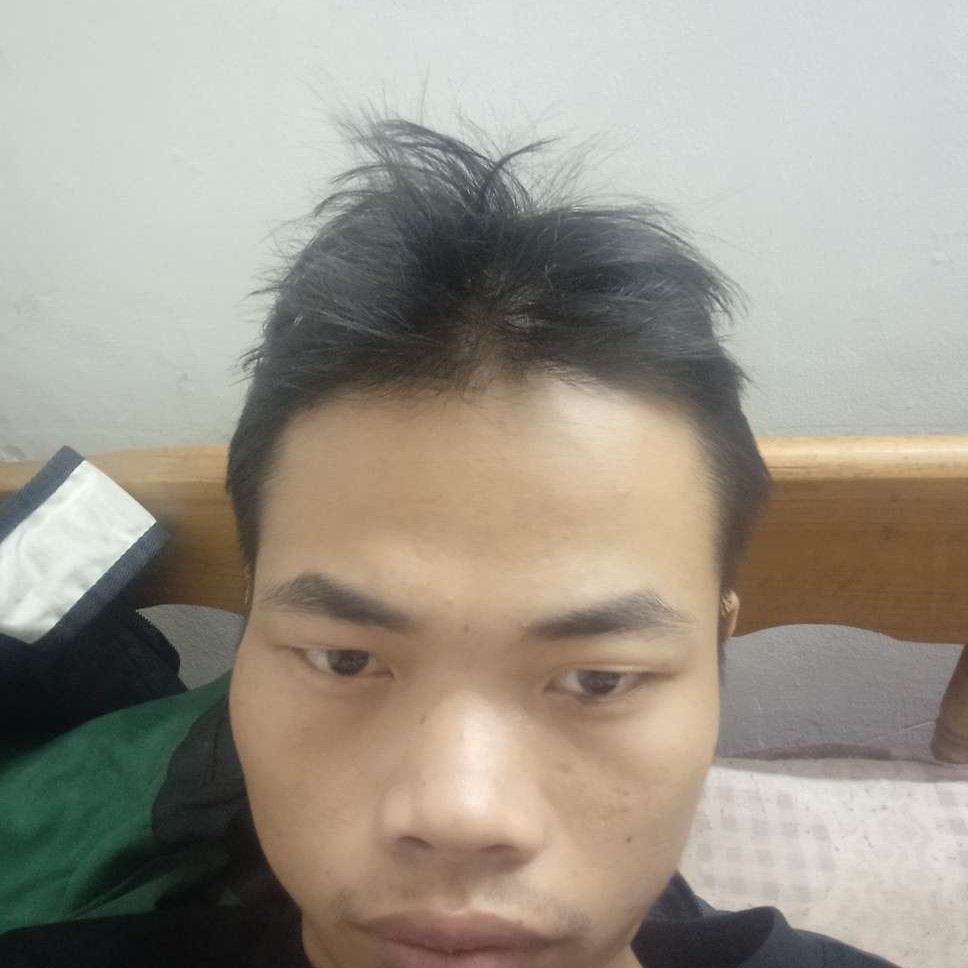 大山蹙眉激昂的照片