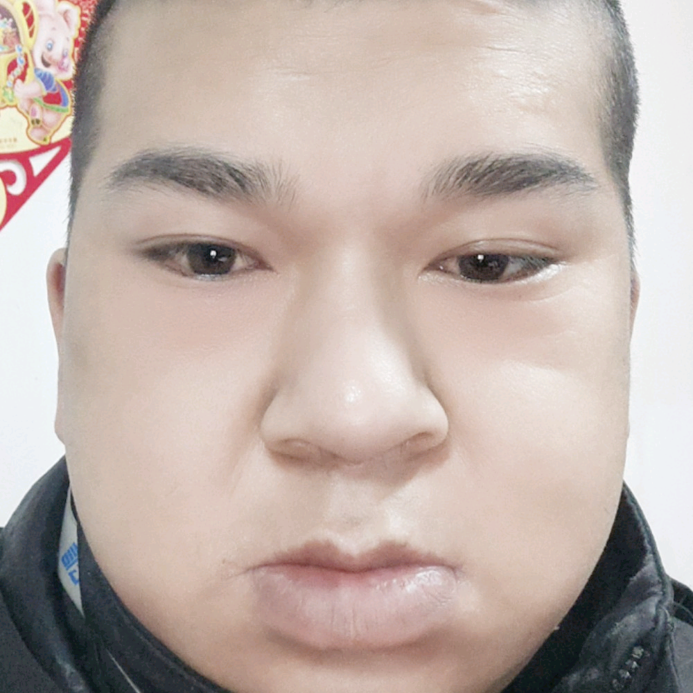 怕黑给火龙果的照片