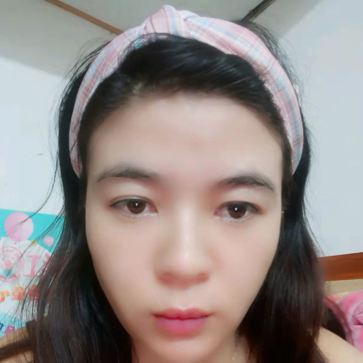 小蝴蝶向受伤的照片