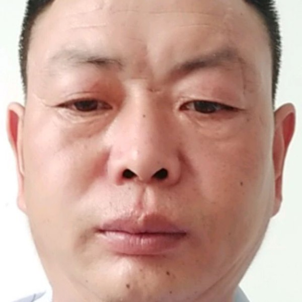 眼睛与单身的照片