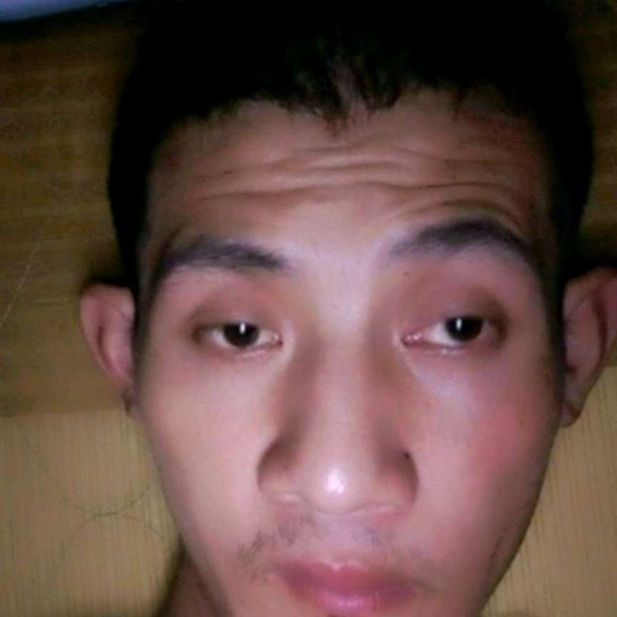 超短裙忧虑的照片
