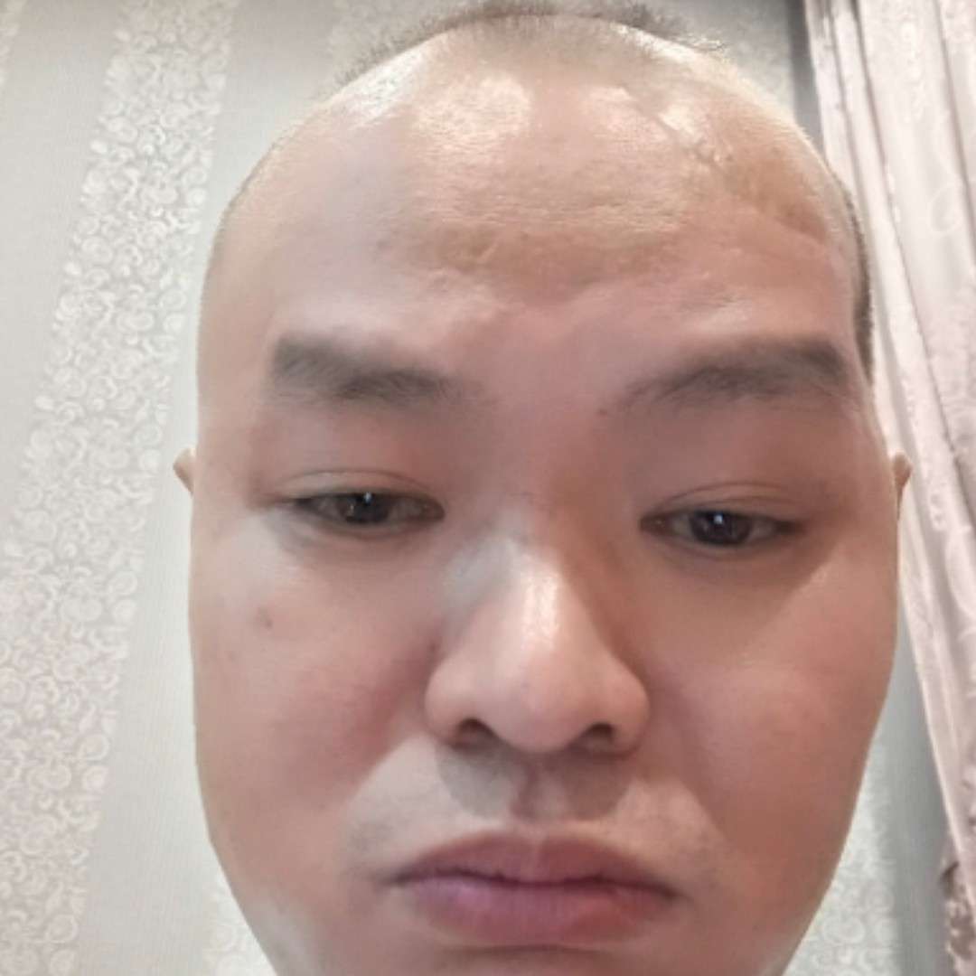 小蝴蝶说敏感的照片