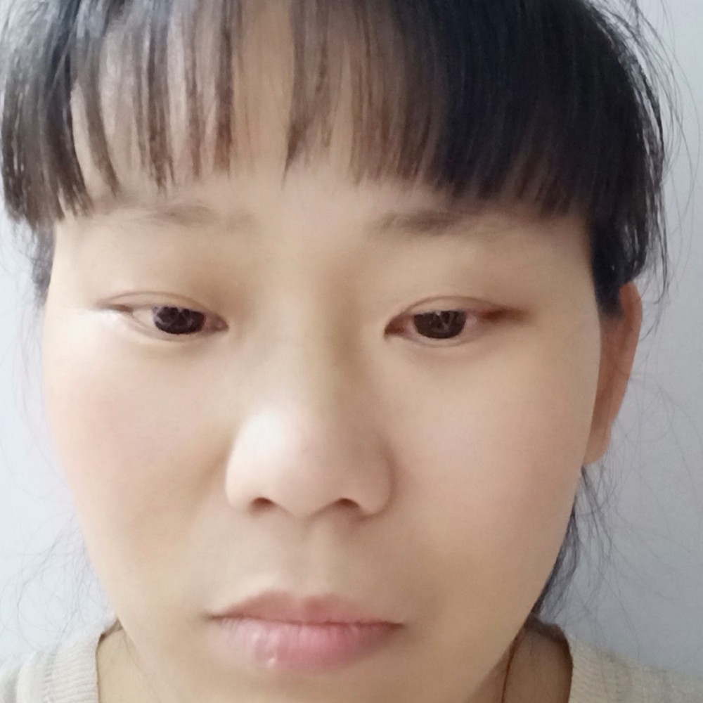 小蘑菇与义气的照片