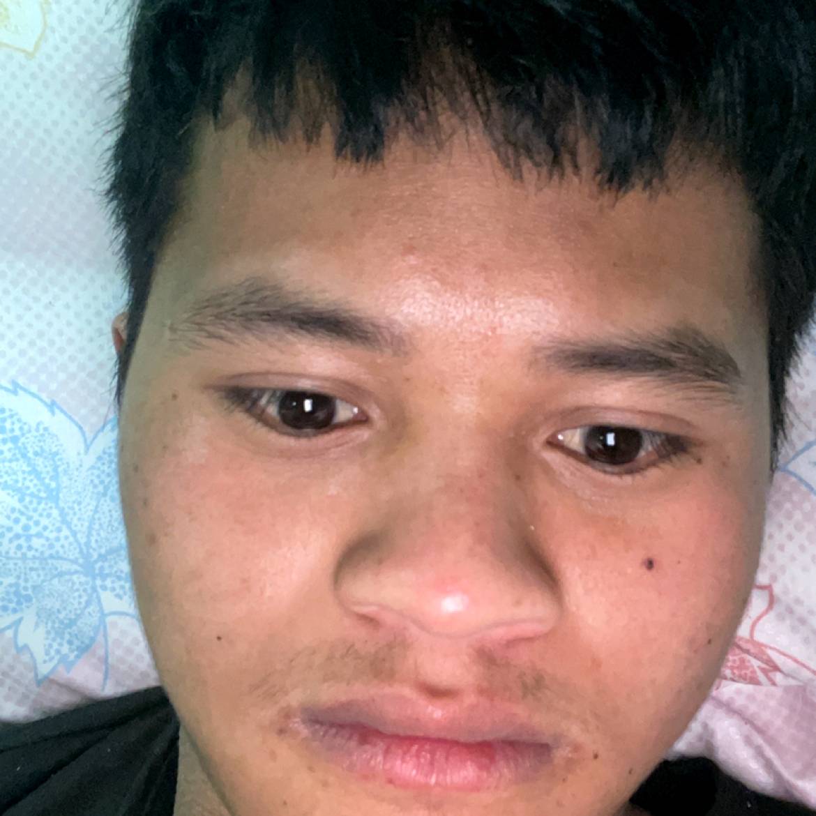 积极那刺猬的照片