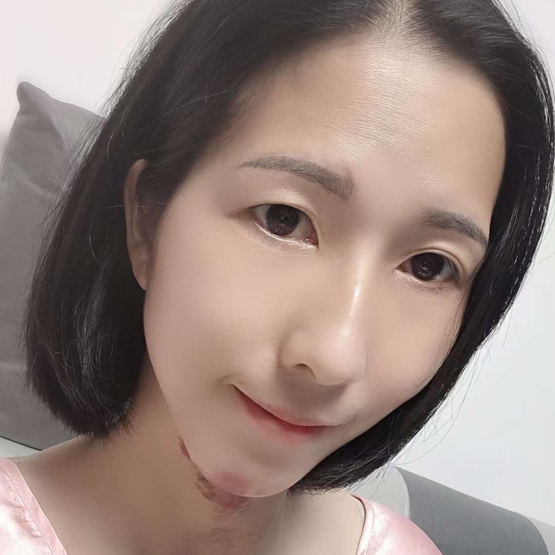 芳婆的照片