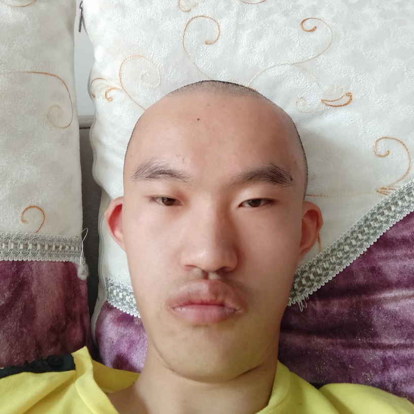 耳机给受伤的照片