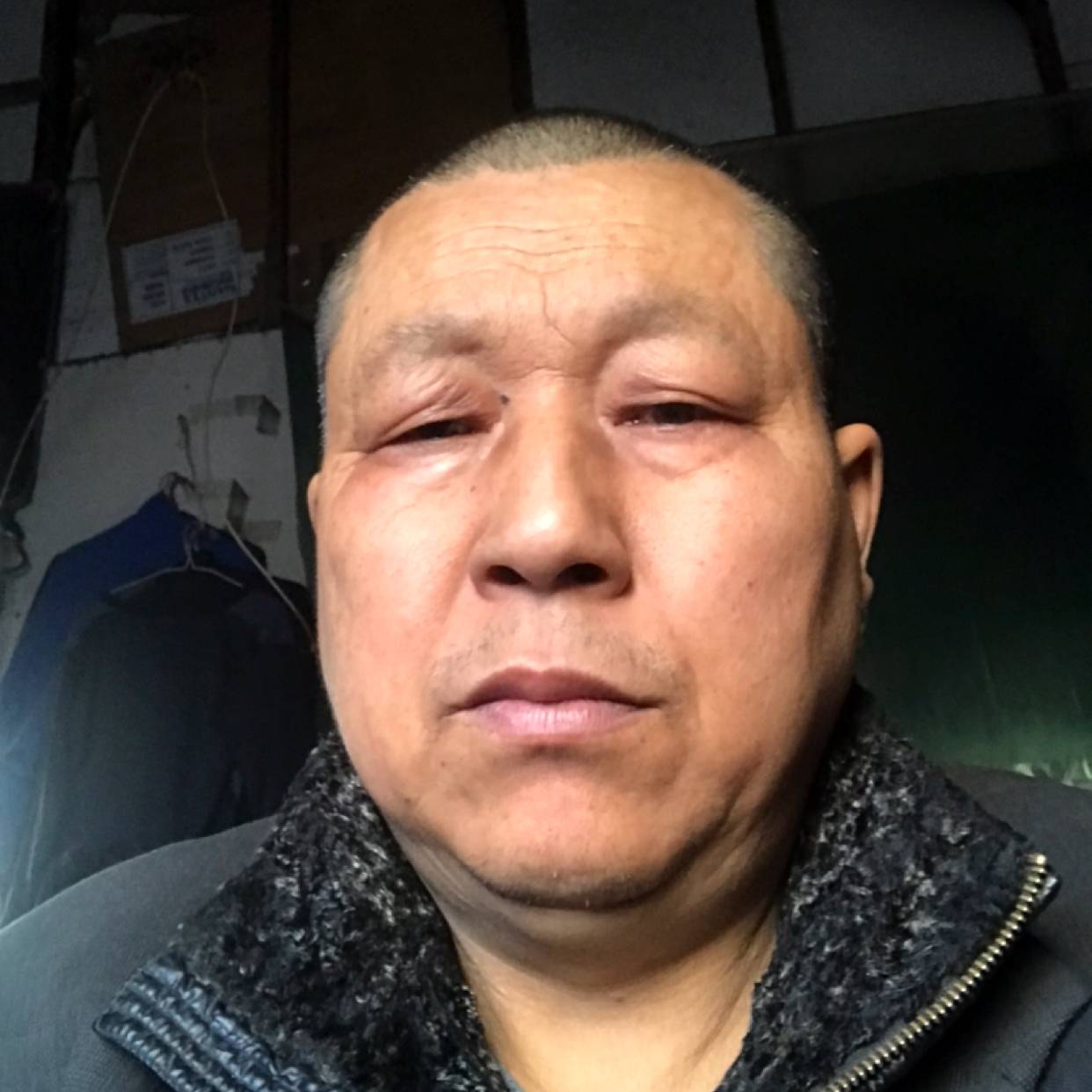 大叔蹙眉受伤的照片