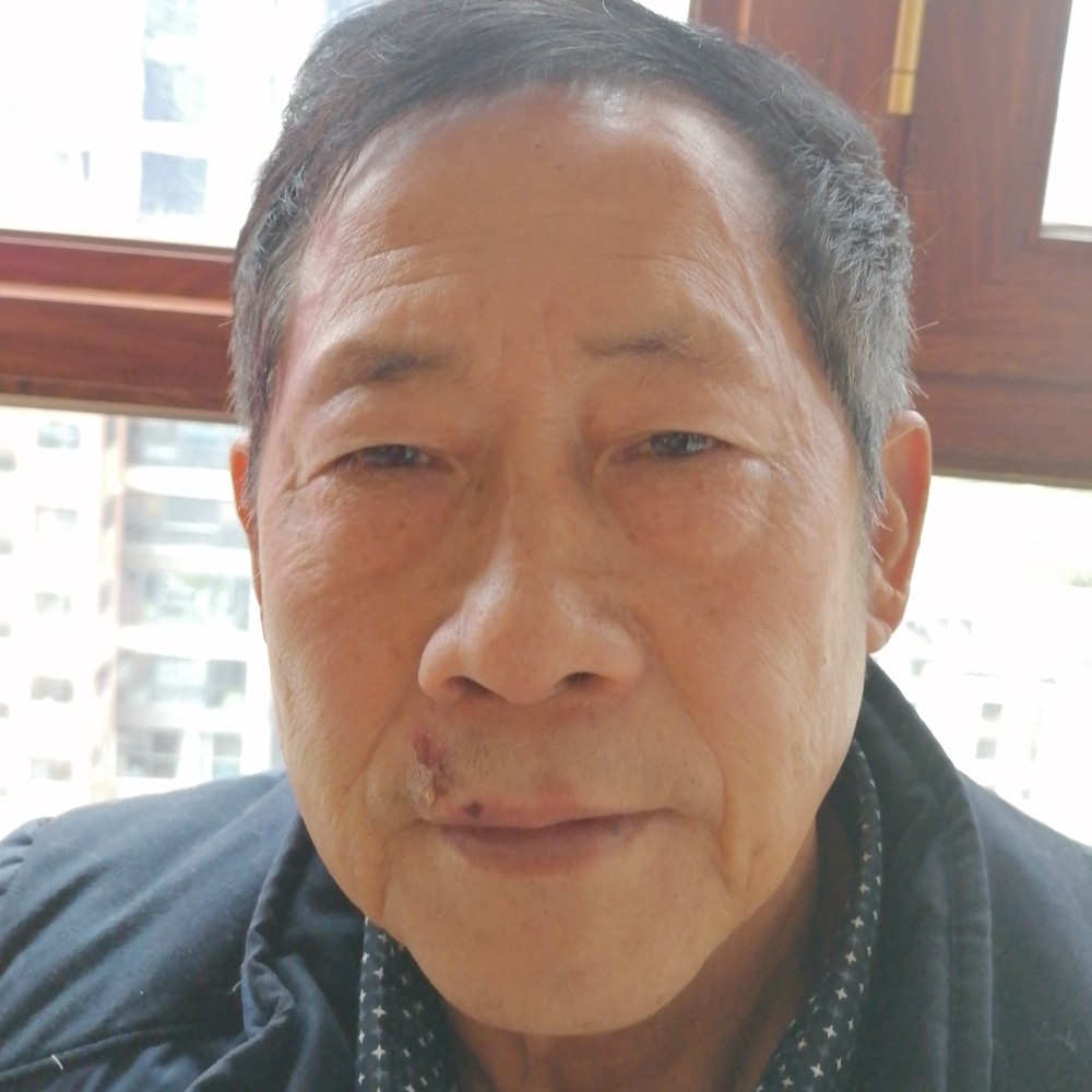 嗯的照片