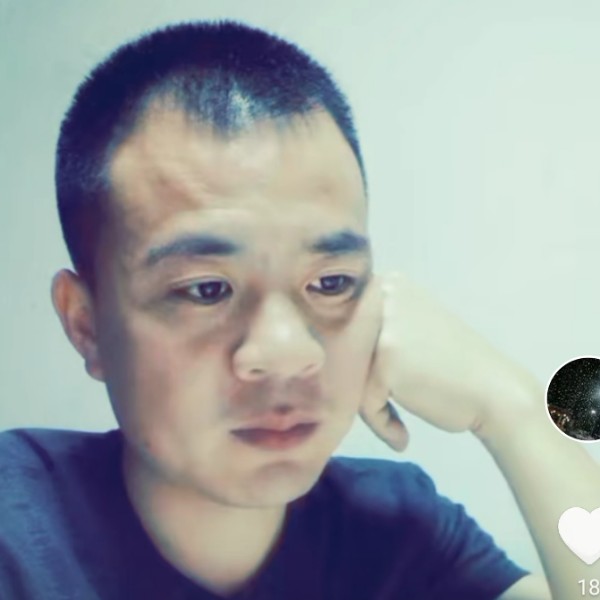 苹果吃醋樱桃的照片