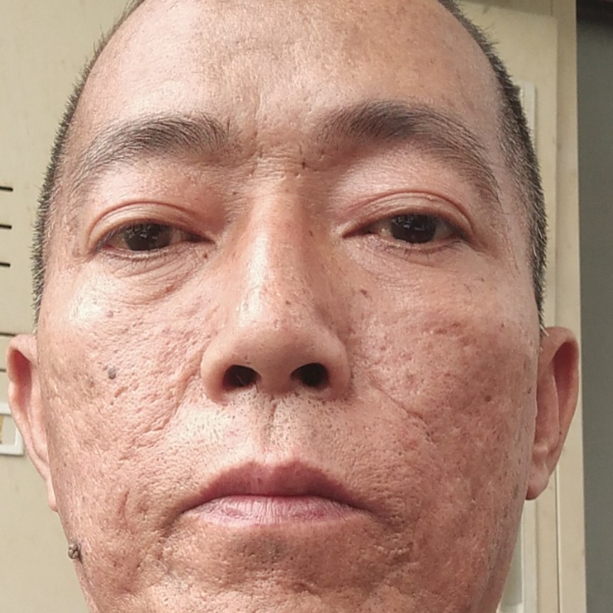震动迎星星的照片