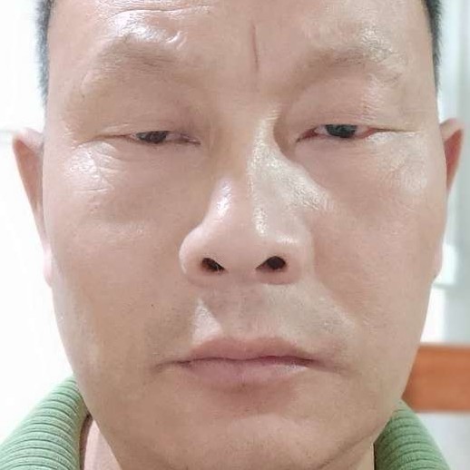 黑挑的照片
