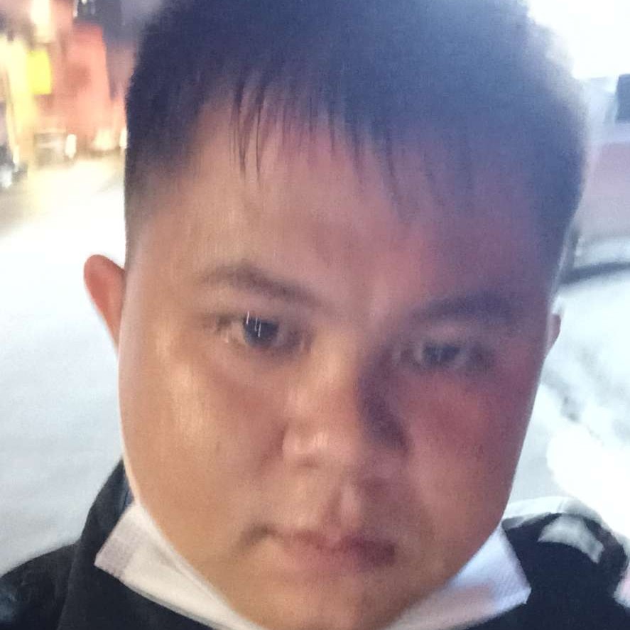害羞等于樱桃的照片