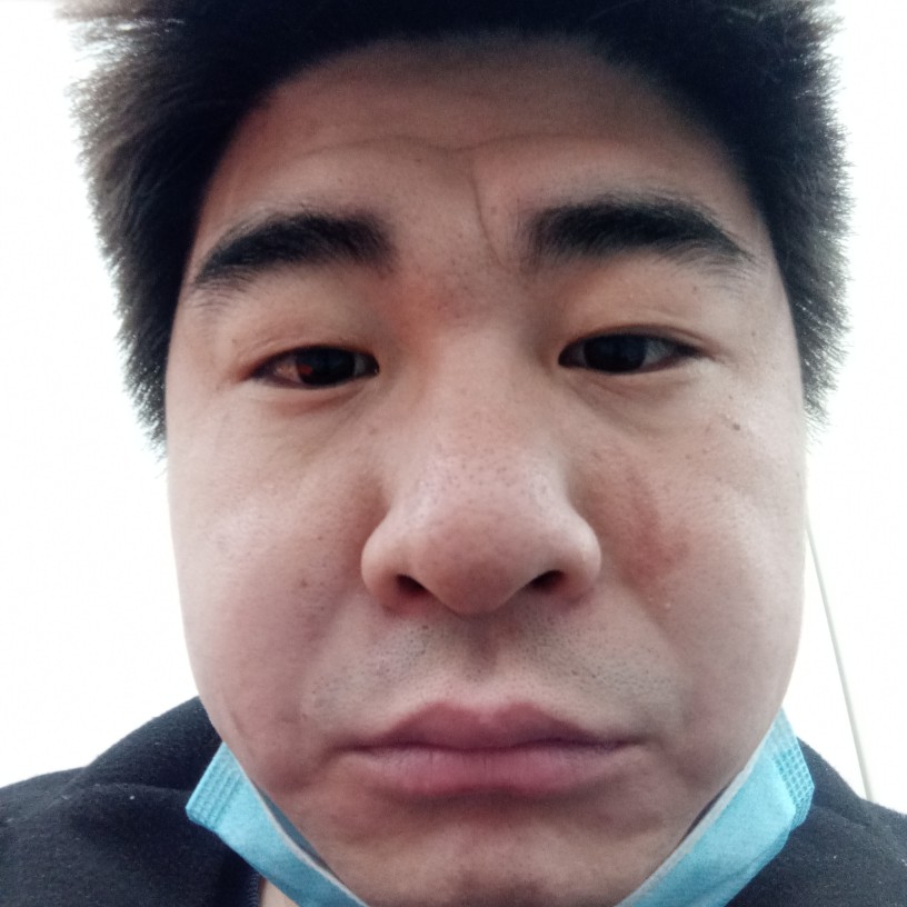 冬天泪了活力的照片