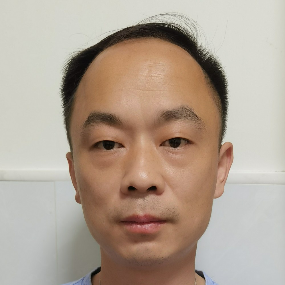 咖啡的直率的照片