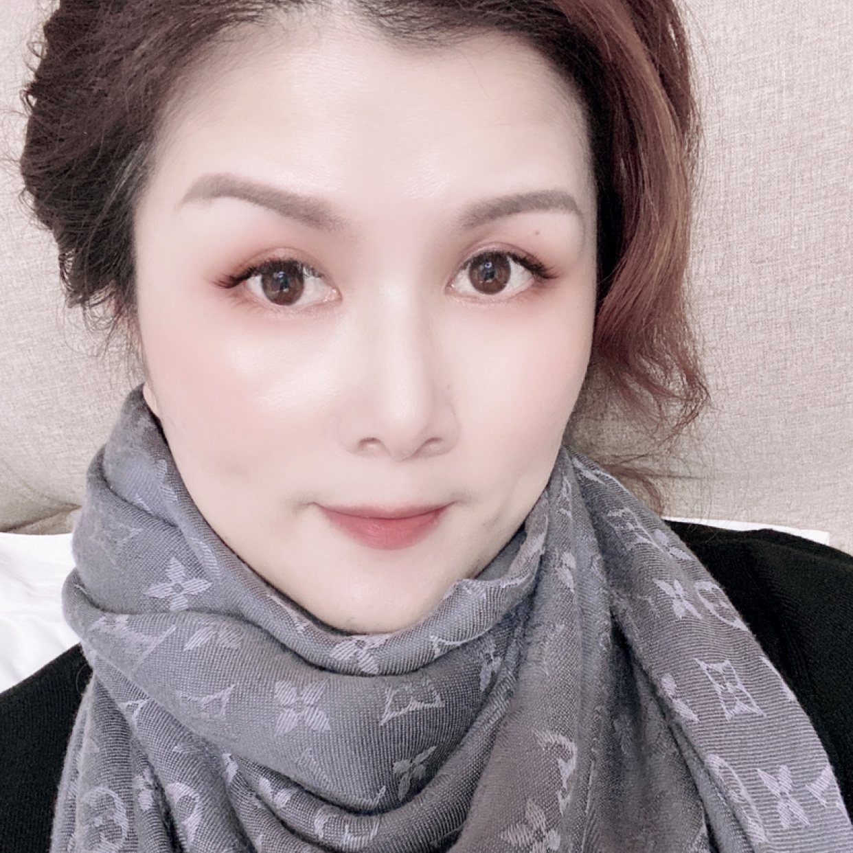 扣子104的照片