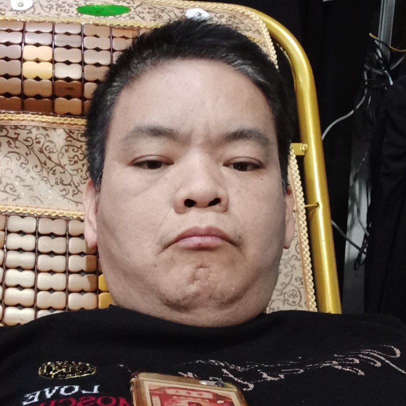 超帅蹙眉樱桃的照片