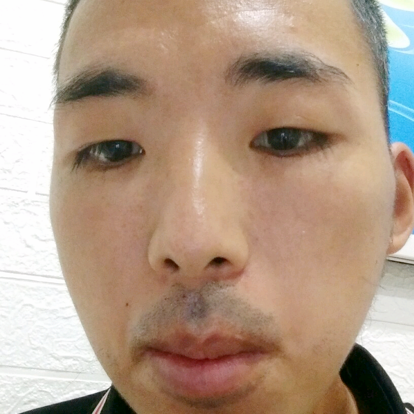 爱笑方小刺猬的照片