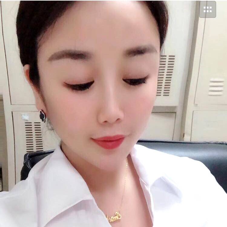 刺猬的照片