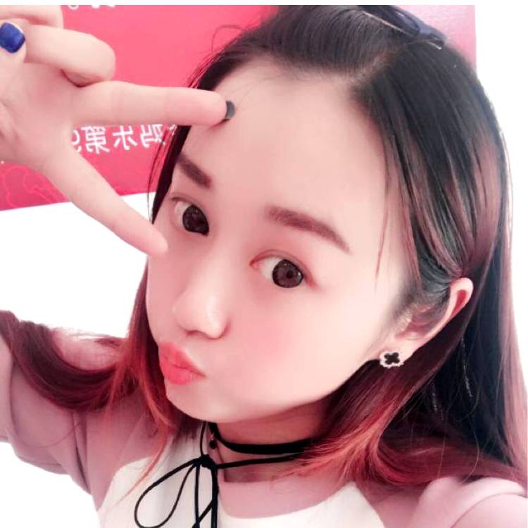 樱桃小丸子~米的照片