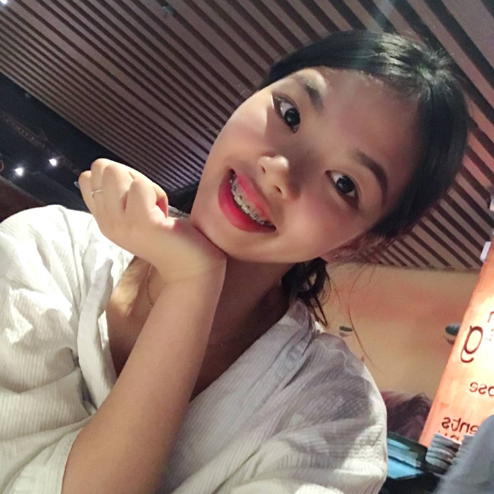 周周，一个钢牙妹的照片