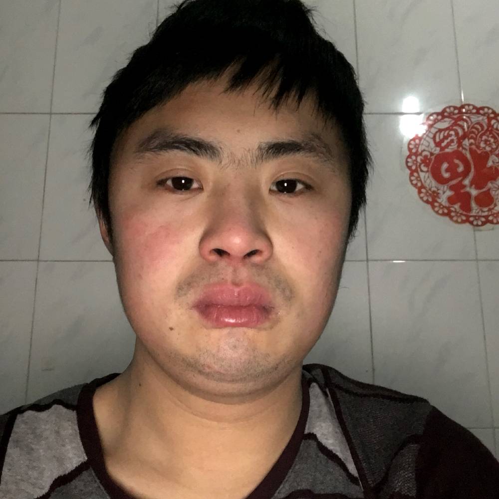 烂漫洋葱人生就是的照片
