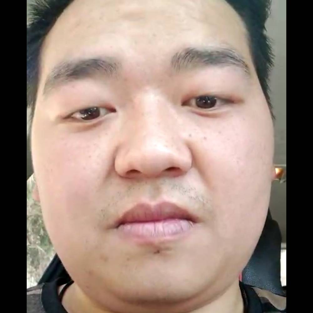 小蚂蚁眼睛小的照片