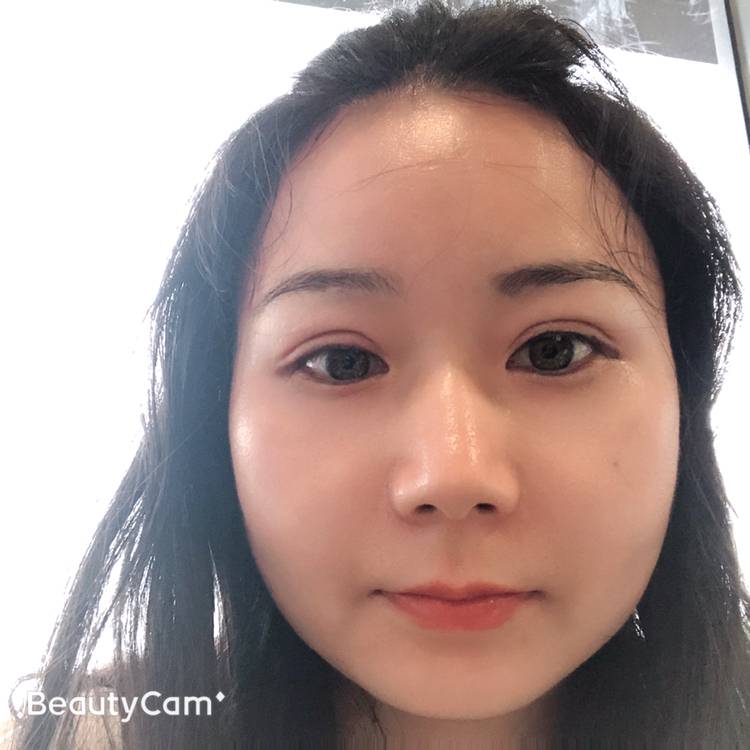细腻請小刺猬的照片