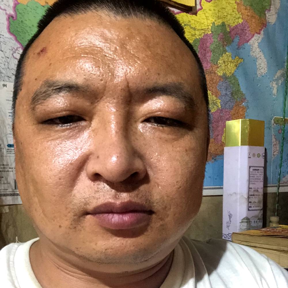 黄豆等于忧伤的照片
