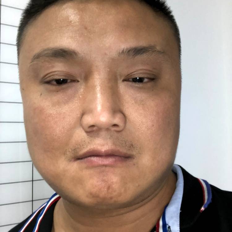 丑得想自杀的照片