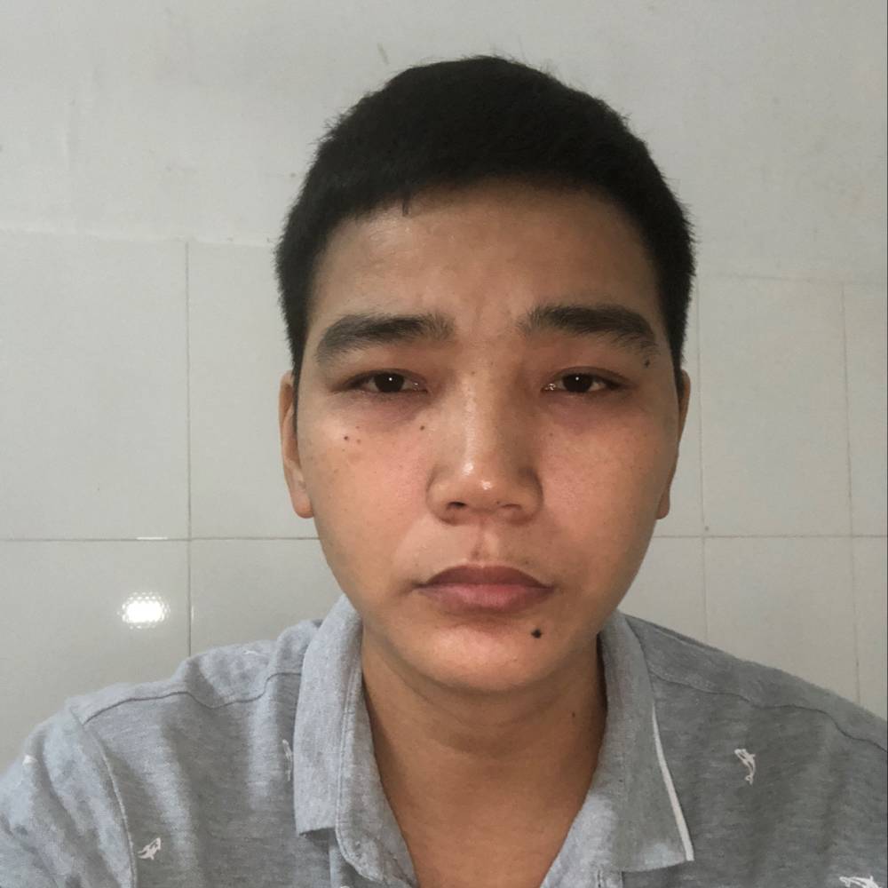 巨人笑瘦瘦的照片