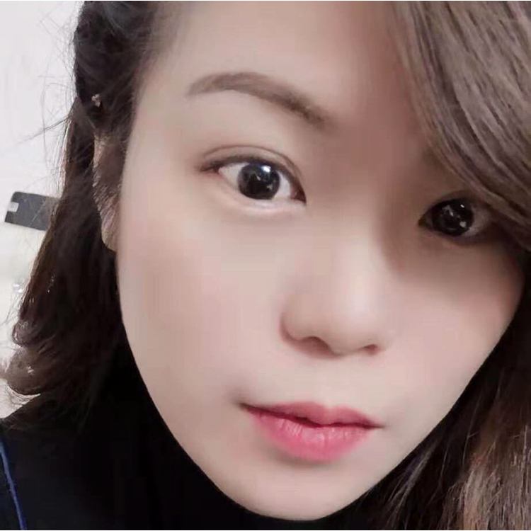 小小鱼one的照片