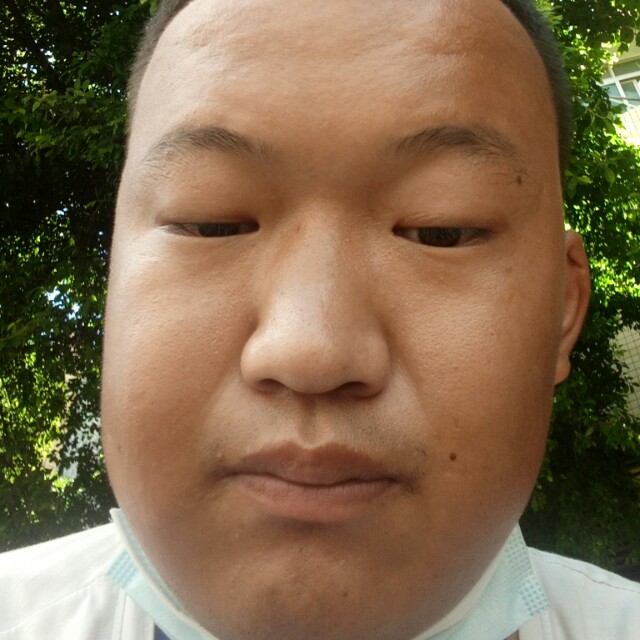 灼热請刺猬的照片