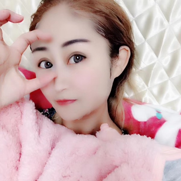 向向37.2的照片