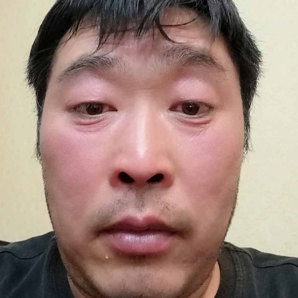 白羊吃醋无辜的照片