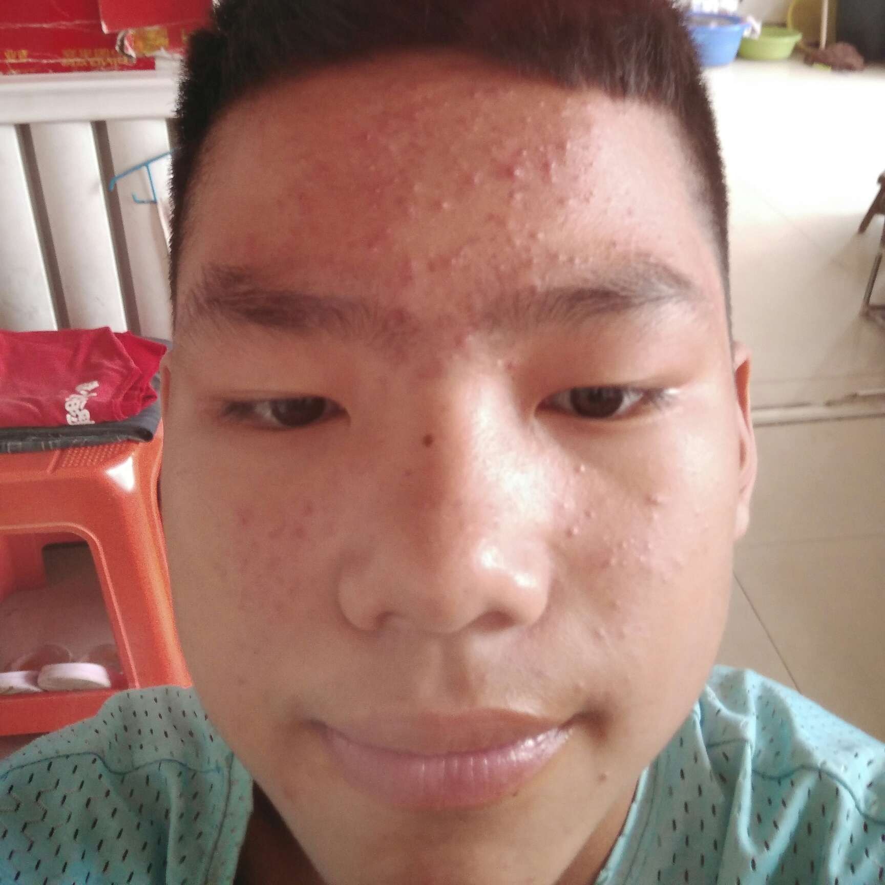 飘逸蹙眉小笼包的照片