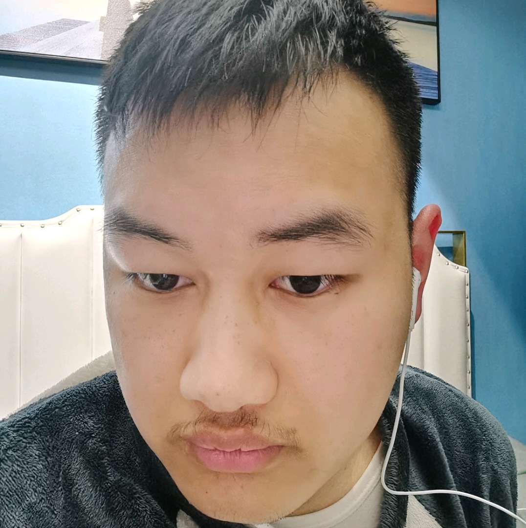 矮穷丑。的照片