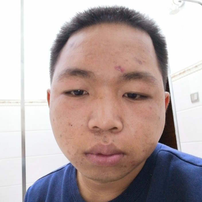 简单用板栗的照片