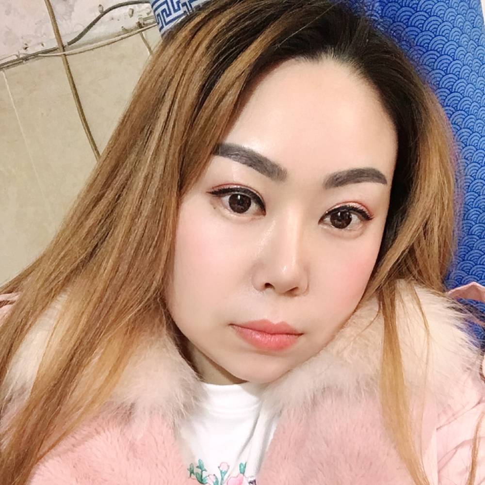 兔子的照片