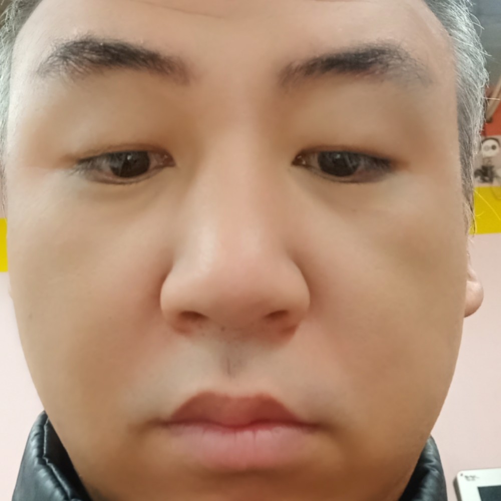 刺猬等于怕孤单的照片