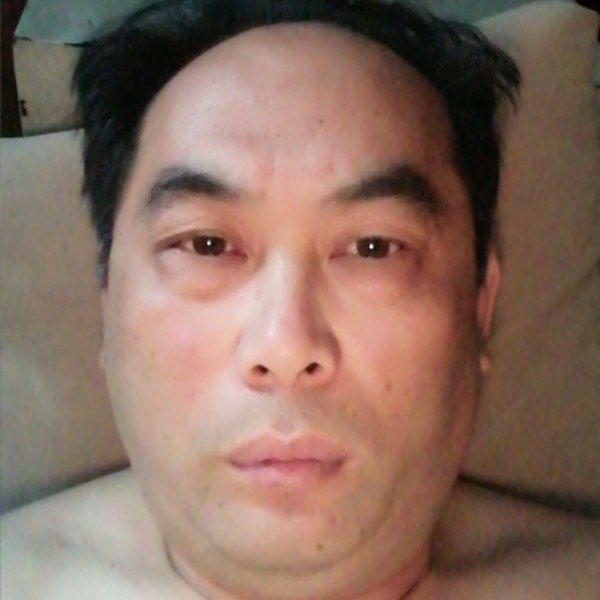 樱桃請懦弱的照片