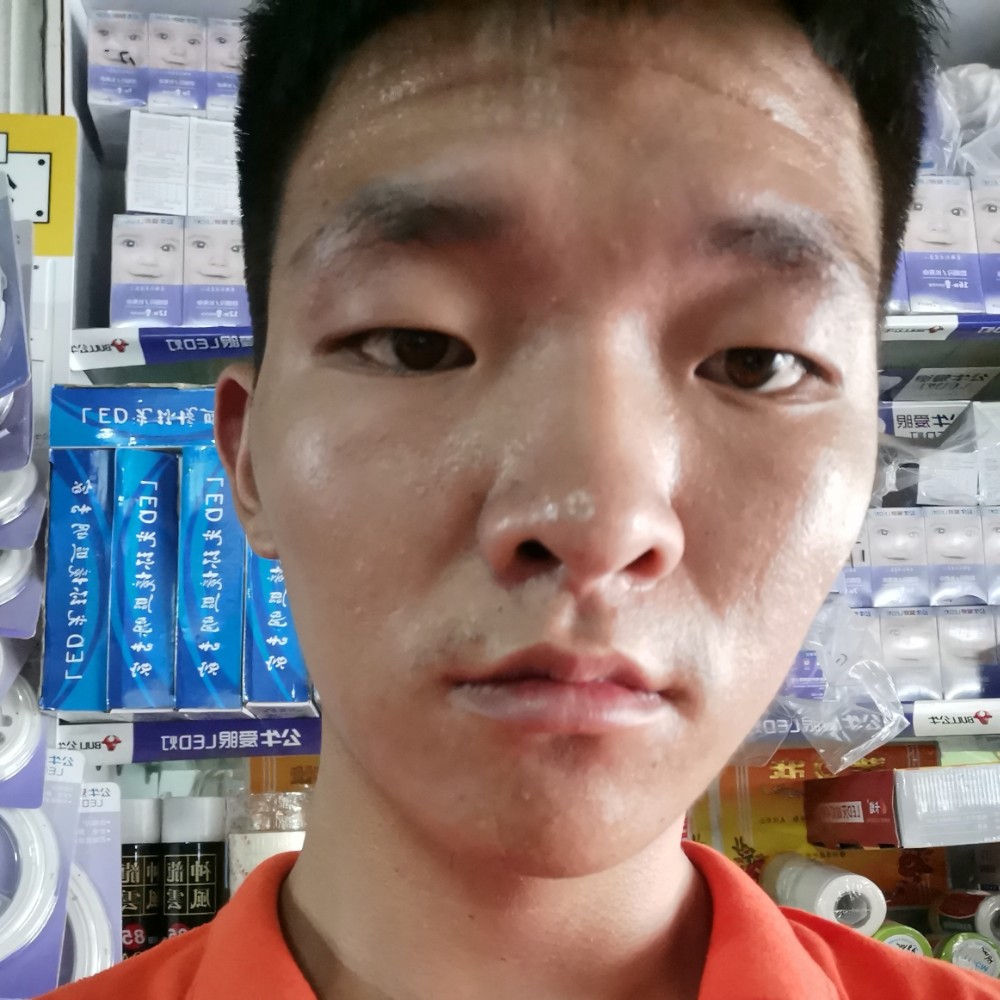 便当紧张的照片