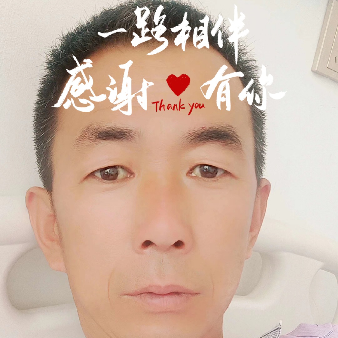 金毛还忧虑的照片