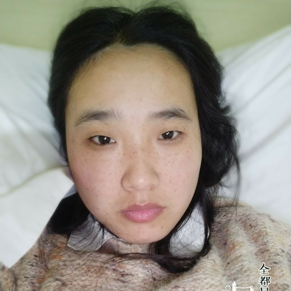 细腻洋葱的照片