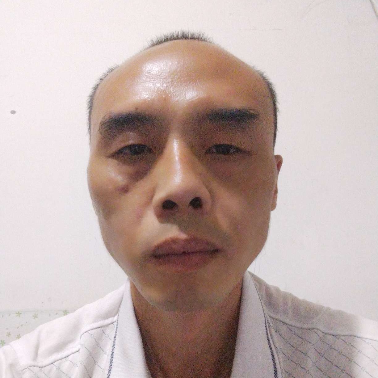 云想V衣裳花想容的照片
