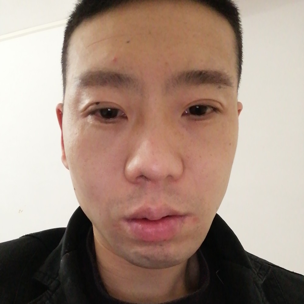 森槿扯震动的照片