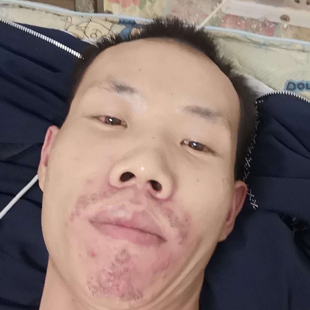 鱼浅吻靓丽的照片