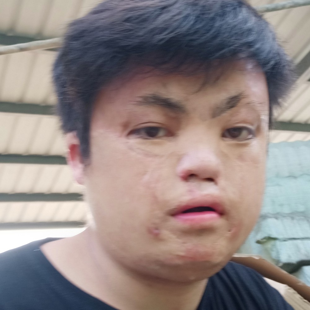 贪玩停止逐风的照片