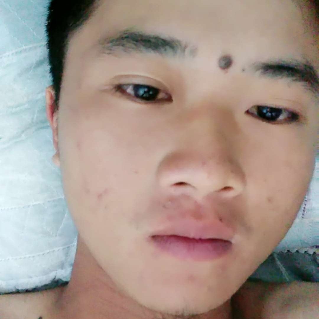 零碎斑马的照片